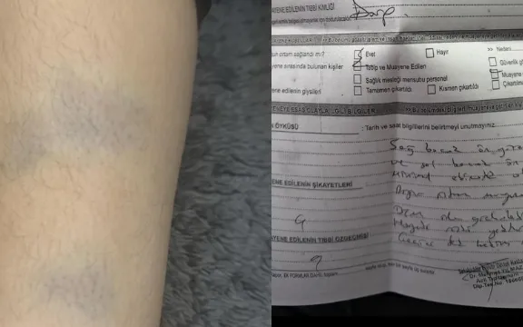 Diyarbakır'da 8 yaşındaki öğrenciye şiddet iddiası